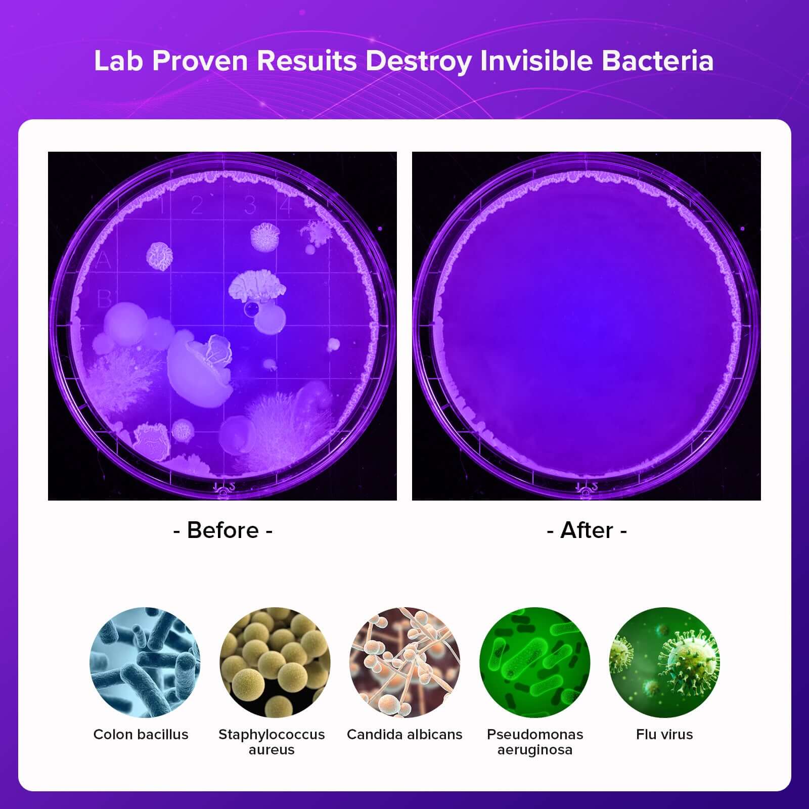 Scatola disinfettante con luce UV da 15 W (SOLO USA)